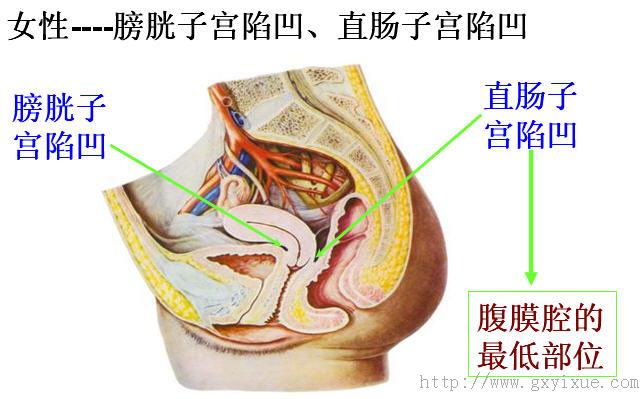 故积液多存在于这些陷凹内女性在膀胱与子宫之间有膀胱子宫陷凹;直肠