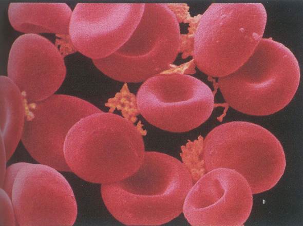 成熟红细胞形态图片