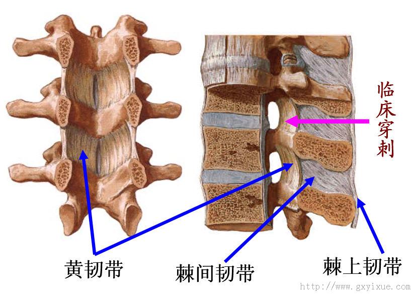 棘间韧带位置图片